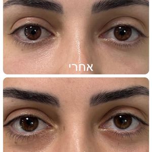 רפואה אסתטית | ד"ר עוז דורי