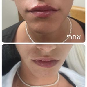 רפואה אסתטית | ד"ר עוז דורי