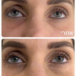 רפואה אסתטית | ד"ר עוז דורי