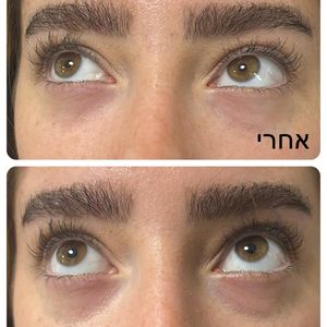 רפואה אסתטית | ד"ר עוז דורי