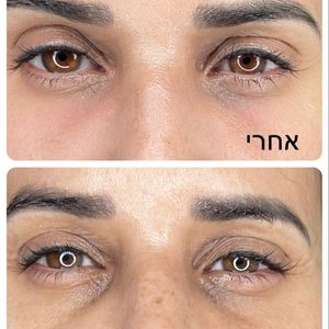 רפואה אסתטית | ד"ר עוז דורי