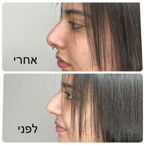 רפואה אסתטית | ד"ר עוז דורי