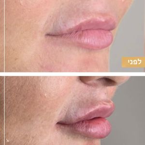רפואה אסתטית | ד"ר ננסי פרידמן