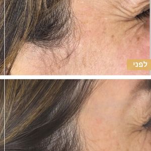 רפואה אסתטית | ד"ר ננסי פרידמן