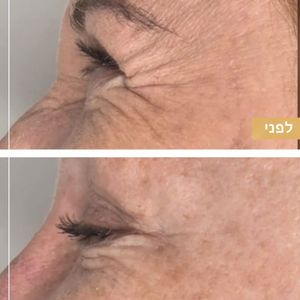 רפואה אסתטית | ד"ר ננסי פרידמן