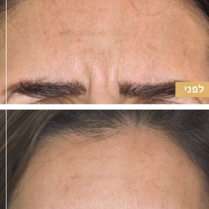 רפואה אסתטית | ד"ר ננסי פרידמן