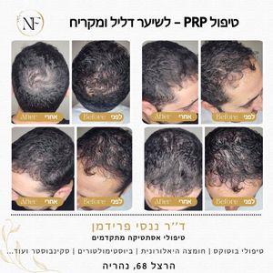 רפואה אסתטית | ד"ר ננסי פרידמן