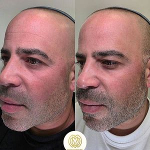 רפואה אסתטית | ד"ר רוז בכור