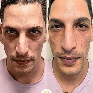 רפואה אסתטית | ד"ר רוז בכור