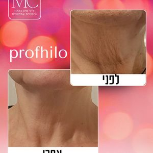 רפואה אסתטית | ד"ר מיא כרמון