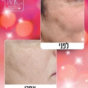 רפואה אסתטית | ד"ר מיא כרמון