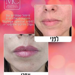 רפואה אסתטית | ד"ר מיא כרמון