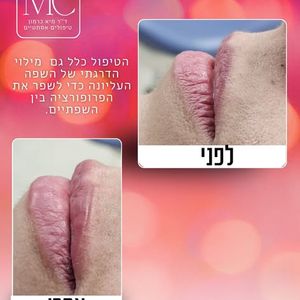 רפואה אסתטית | ד"ר מיא כרמון