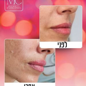 רפואה אסתטית | ד"ר מיא כרמון