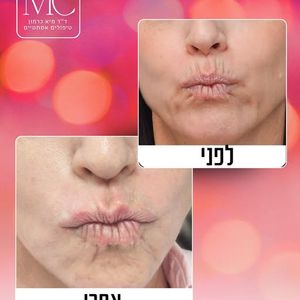 רפואה אסתטית | ד"ר מיא כרמון