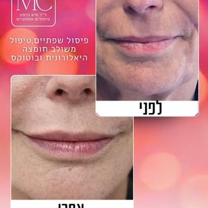 רפואה אסתטית | ד"ר מיא כרמון