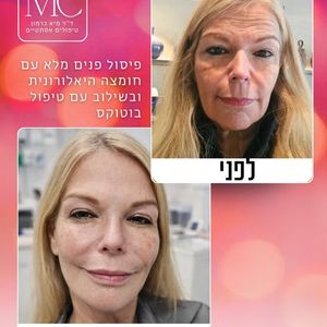 רפואה אסתטית | ד"ר מיא כרמון
