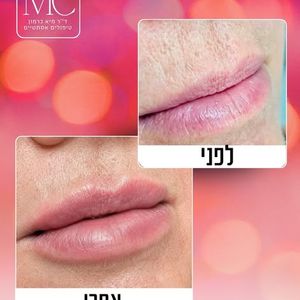 רפואה אסתטית | ד"ר מיא כרמון