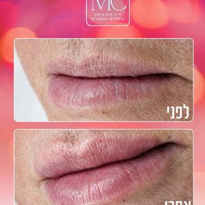 רפואה אסתטית | ד"ר מיא כרמון