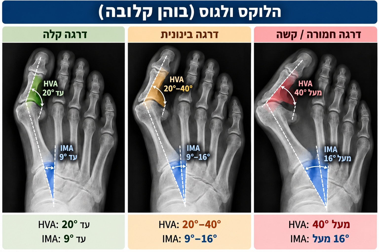 סוגים של הלוקס ולגוס סוגים של הלוקס ולגוס